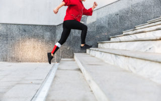 gold coast surgicenter When Can I Start Running After ACL Surgery